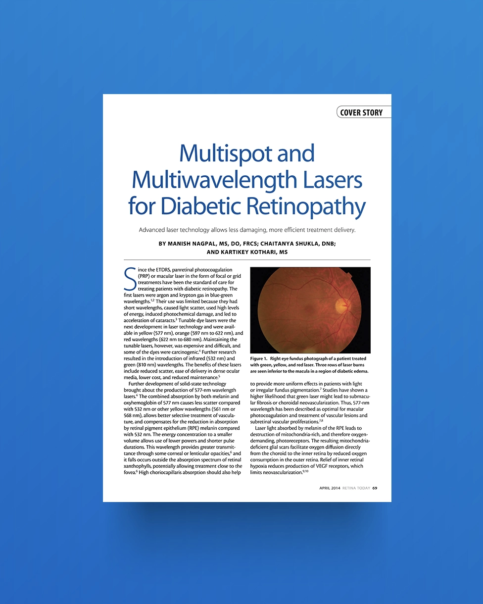 Multispot and Multiwavelength Lasers for Diabetic Retinopathy