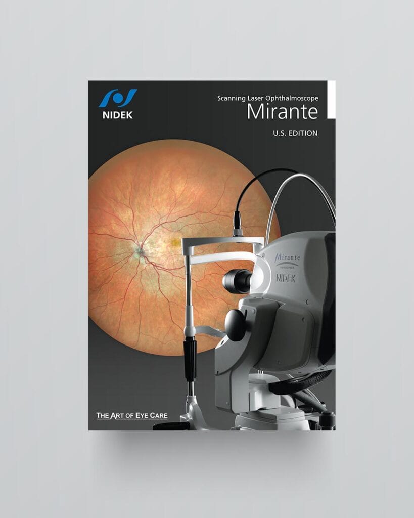 Mirante: Scanning Laser Ophthalmoscope