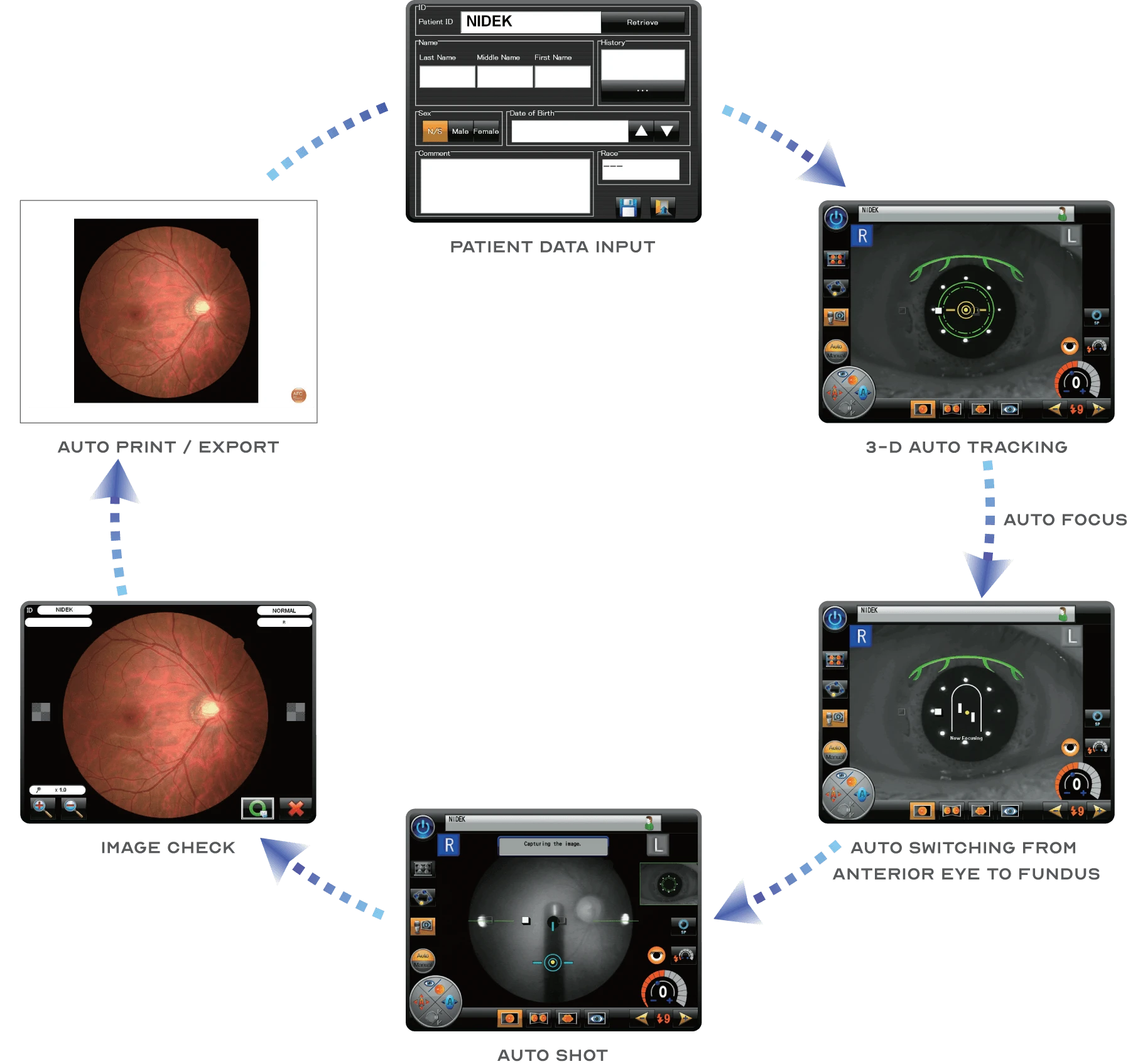 Diagram Showcasing The Workflow Of Using A Nidek Ophthalmologic Device. The Process Includes: Opening A Patient Profile, Capturing And Processing Retinal Images, Aligning The Eye, Analyzing Measurements, And Displaying Results On A Computer Interface.