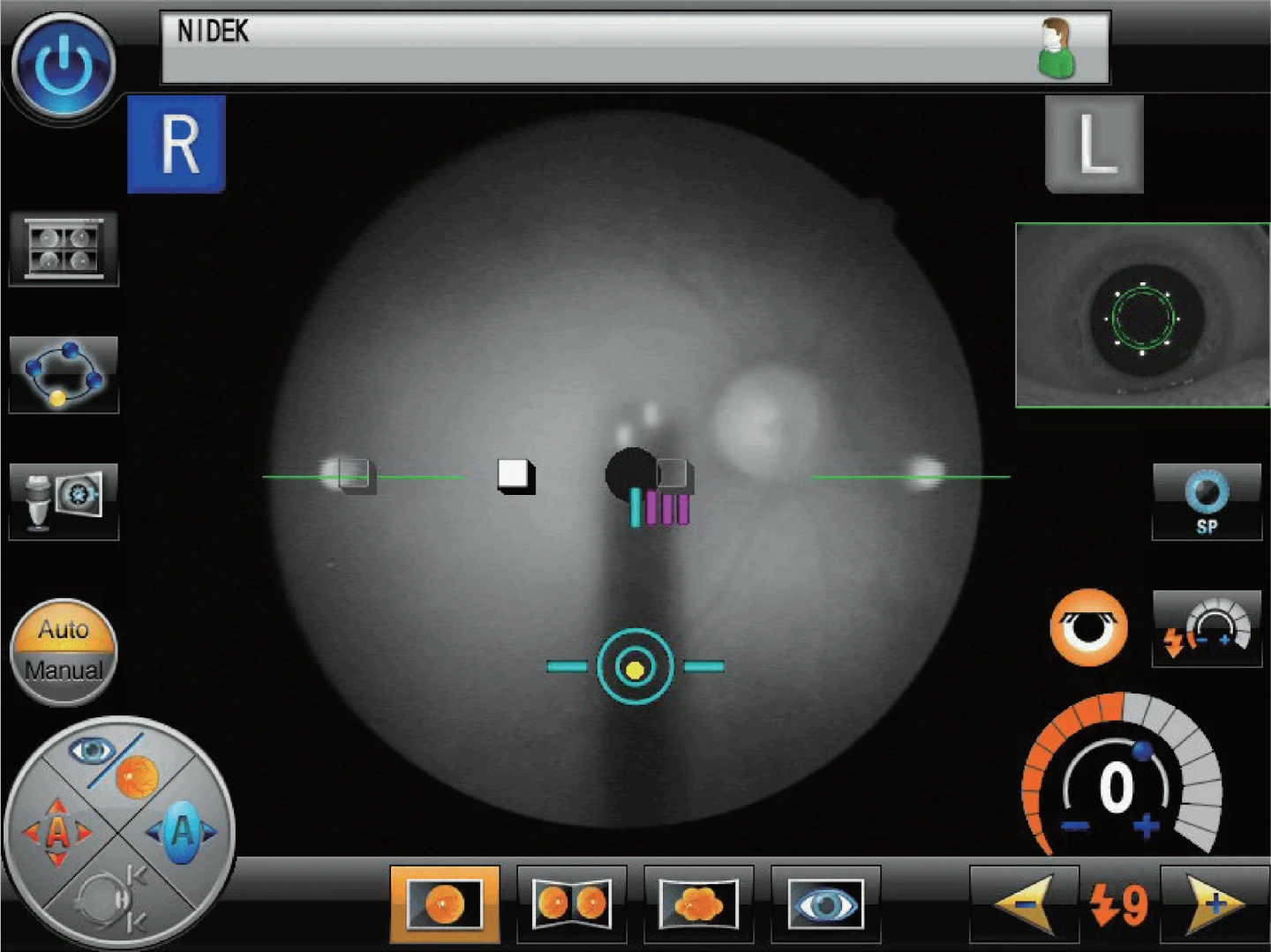 A Display Screen Of A Nidek Ophthalmic Device Shows Live Imaging Of An Eye. The Central Circular Section Displays A Gray-Scale Eye Scan With Various Markers And Measurements. Surrounding The Main Image Is A User Interface With Various Controls And Icons.
