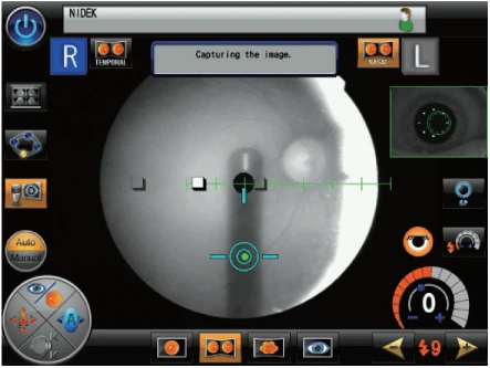 A Nidek Medical Interface Screen Shows The Process Of Eye Imaging. Various Buttons And Controls Surround A Large Central Circular Image Of An Eye. A Caption Reads &Quot;Capturing The Image.&Quot; The Layout Includes Icons, Measurements, And Different Setting Options.
