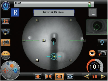A Nidek Medical Imaging Interface Displaying An Eye Examination In Progress. The Screen Shows A Circular Eye Image With Crosshairs And Markers, Various Control Buttons On The Left And Bottom, And Status Text Reading &Quot;Capturing The Image.&Quot; The Background Is Predominantly Black.