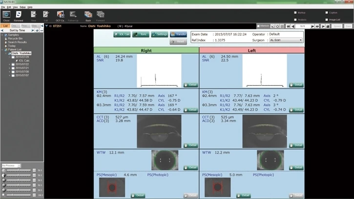 Screenshot Of A Nidek Eye Examination Software Interface Displaying Various Measurements And Images Related To Eye Metrics For Both The Right And Left Eyes. The Interface Includes Several Sections With Graphs, Numbers, And Eye Images, Along With A Menu On The Left Side.