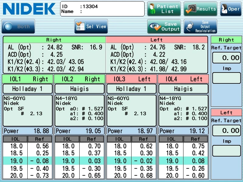 The Medical Equipment Display From Nidek Showcases Patient Optical Measurements. The Screen Includes Detailed Data Such As Al, Acd, K1/K2, And Snr For Both Eyes Across Multiple Iol Calculations. Buttons For Patient List, Results, Save Output, And Settings Are Prominently Visible.