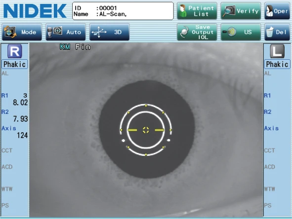 Close-Up View Of A Nidek Medical Device'S Display Screen, Showing An Eye Examination In Progress. The Screen Captures The Detailed Image Of An Eye With Concentric Circles And Measurement Indicators. Various Control Buttons And Information Panels Are Visible Around The Display.