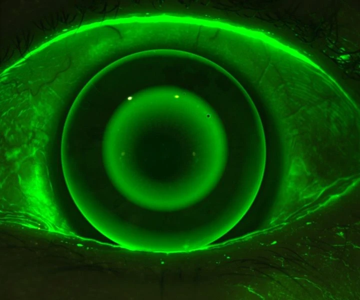 Close-Up Image Of A Green Eye With A Dark Pupil. The Eye Appears To Be Illuminated With A Neon Green Glow, Giving It An Otherworldly And Futuristic Appearance. The Surrounding Skin Is Slightly Visible, Adding To The Contrast Of The Vibrant Green Light, Reminiscent Of Advanced Nidek Technology.