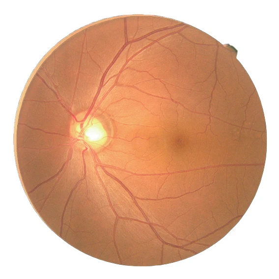 Image Of A Healthy Human Retina Captured Using Nidek Technology. The Circular Structure Shows The Optic Disc On The Left, Where Blood Vessels Converge. The Macula, Responsible For Central Vision, Is Slightly Off-Center To The Right. The Image Highlights The Network Of Blood Vessels.