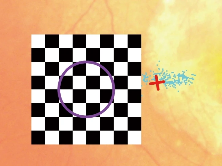 A Black And White Checkerboard Pattern With A Purple Circle Superimposed Over The Squares. To The Right Of The Checkerboard, A Red Plus Sign Is Surrounded By Small Blue Dots Against An Orange And Yellow Background, Evoking A Design Reminiscent Of Nidek'S Precision Instruments.
