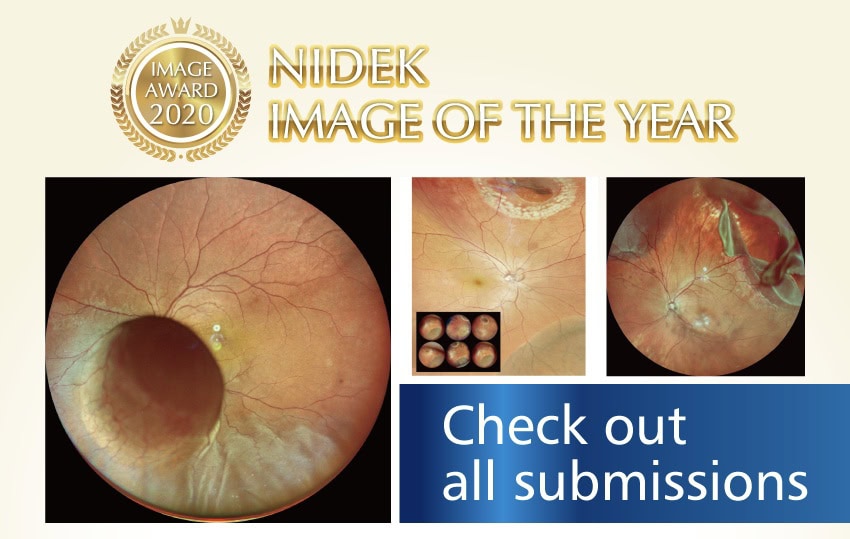 Promotional Poster For The Nidek Image Of The Year Award 2020. It Features Three Retinal Images, Each Showcasing Intricate Details Of The Eye. The Text Reads, &Quot;Nidek Image Of The Year 2020&Quot; And &Quot;Check Out All Submissions.