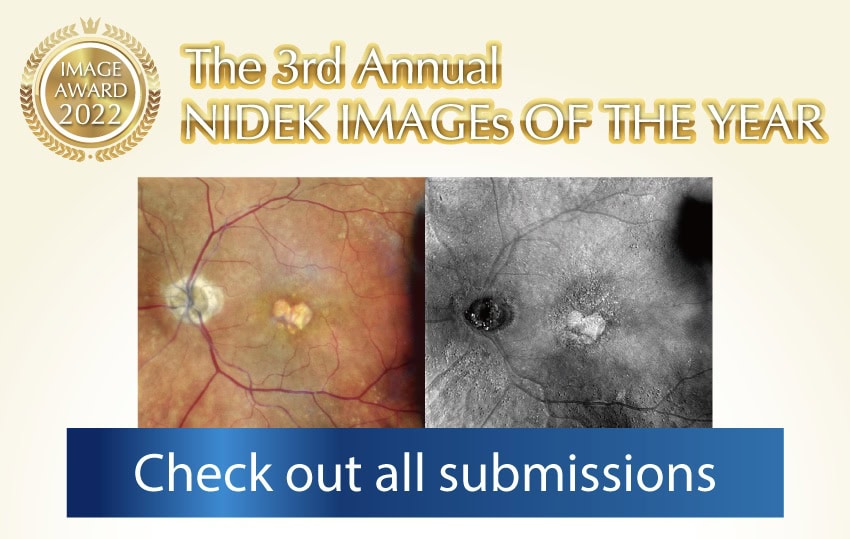 Image Featuring The Announcement For The 3Rd Annual Nidek Images Of The Year With An &Quot;Image Award 2022&Quot; Badge. The Banner Includes Retinal Images, One In Color And One In Black And White. A Blue Text Box At The Bottom Reads &Quot;Check Out All Nidek Submissions.