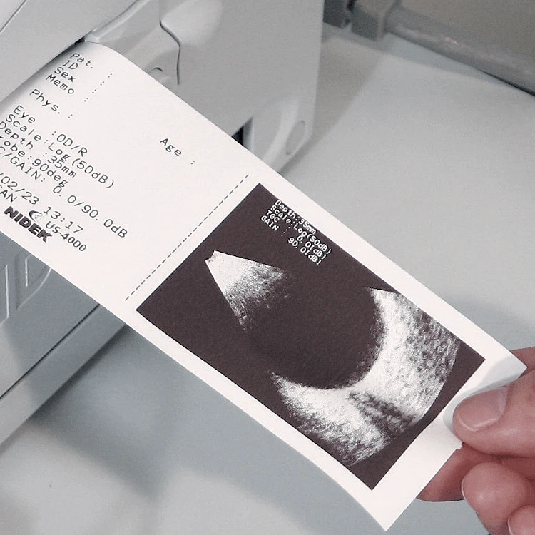 A Person'S Hand Is Holding A Printout From A Nidek Medical Device. The Printout Includes Text And A Black-And-White Ultrasound Image, Possibly Of An Eye. In The Background, Part Of The Nidek Medical Device From Which The Printout Was Generated Is Visible.
