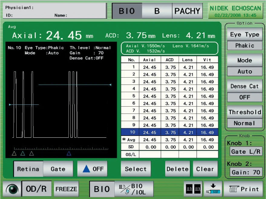 A Nidek Medical Device Screen Displaying Ophthalmic Diagnostic Information. Parameters Include Axial Length, Anterior Chamber Depth, And Lens Thickness. Menus Show Eye Type, Pulse Mode, Gain, Threshold, And Gate Options. Control Buttons Are At The Bottom.