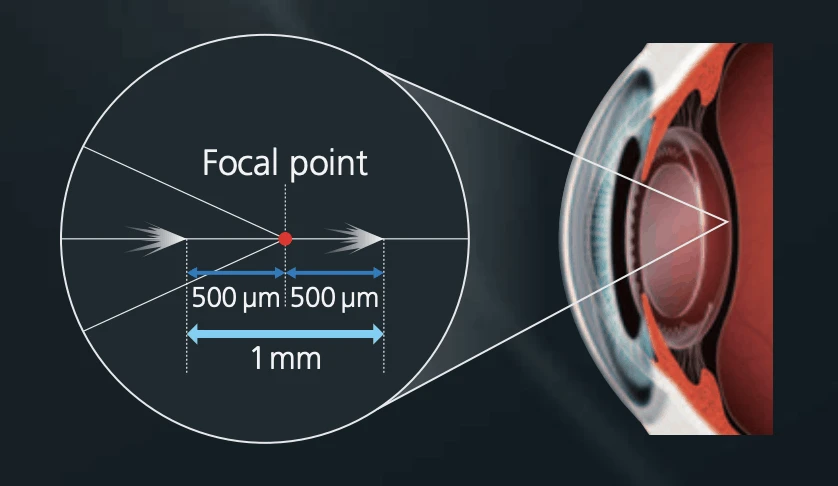 An Illustration Showing A Detailed View Of A Focal Point Within An Optical Element, With Dimensions Marked In Micrometers (500 Μm X 500 Μm) And Millimeters (1 Mm). The Optical Element, From Nidek, Is Magnified On The Right Side Of The Image, Highlighting Its Structure.