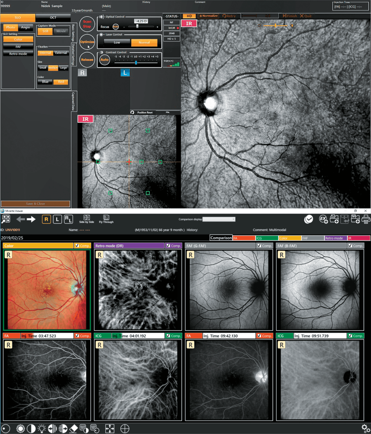 Medical Imaging Software From Nidek Displaying Detailed Retinal Scans. The Interface Contains Various Tools, Settings, And A Series Of Nine Detailed Images Showing Different Views Of The Retina, Highlighting Veins And Macula.