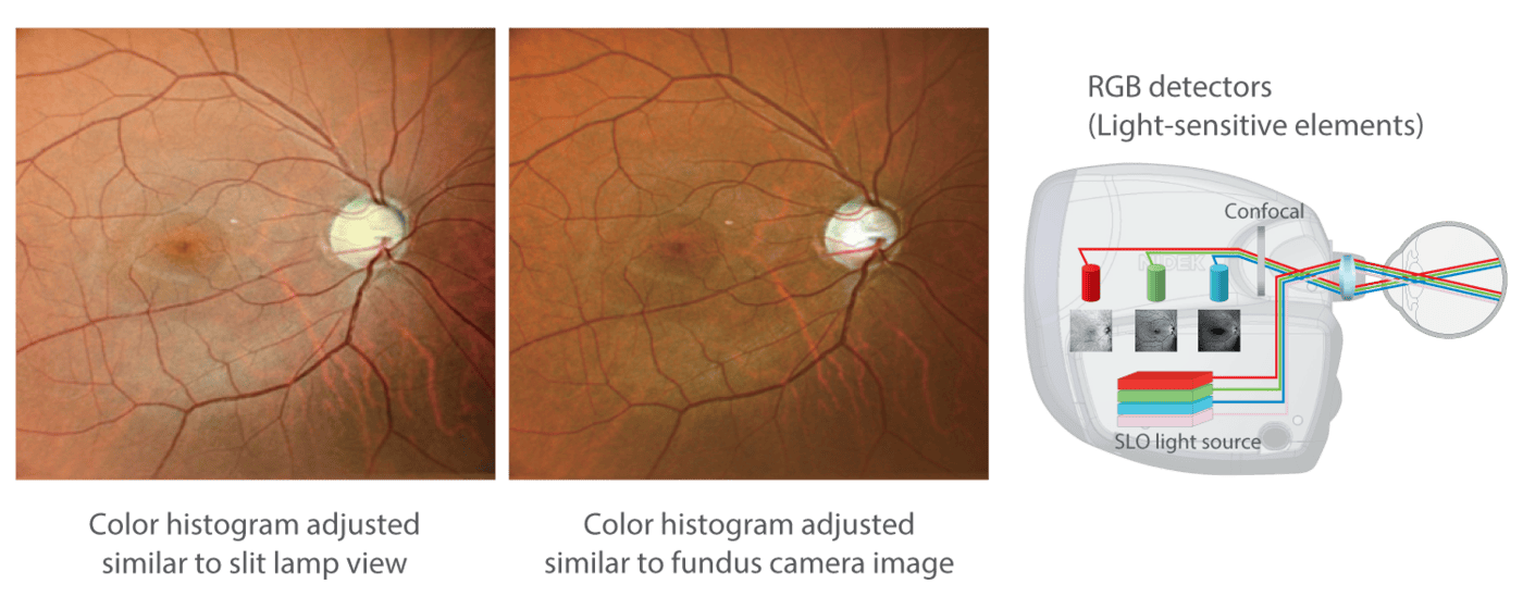 This Image Depicts Two Retina Scans Side By Side With Adjusted Color Histograms: One Similar To Slit Lamp And The Other To Fundus Camera Imaging. To The Right, There'S A Diagram Explaining The Rgb Detectors And Light-Sensitive Elements Used In Obtaining These Nidek Images.