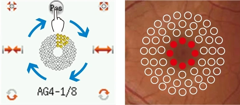 A Diagram Displaying A Retinal Examination Process. The Left Side Shows A Hand Pointing At A 'Pos' Button, With Circular Patterns And Directional Arrows Around. The Right Side Features A Nidek Retina Illustration With White And Red Circles Indicating Examination Points.