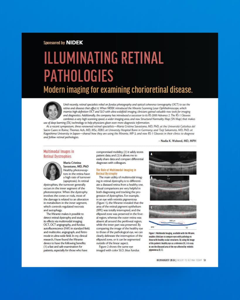 Illuminating Retinal Pathologies